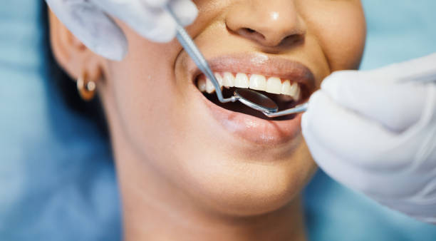 Best Weekend Emergency Dentist in Holley, FL